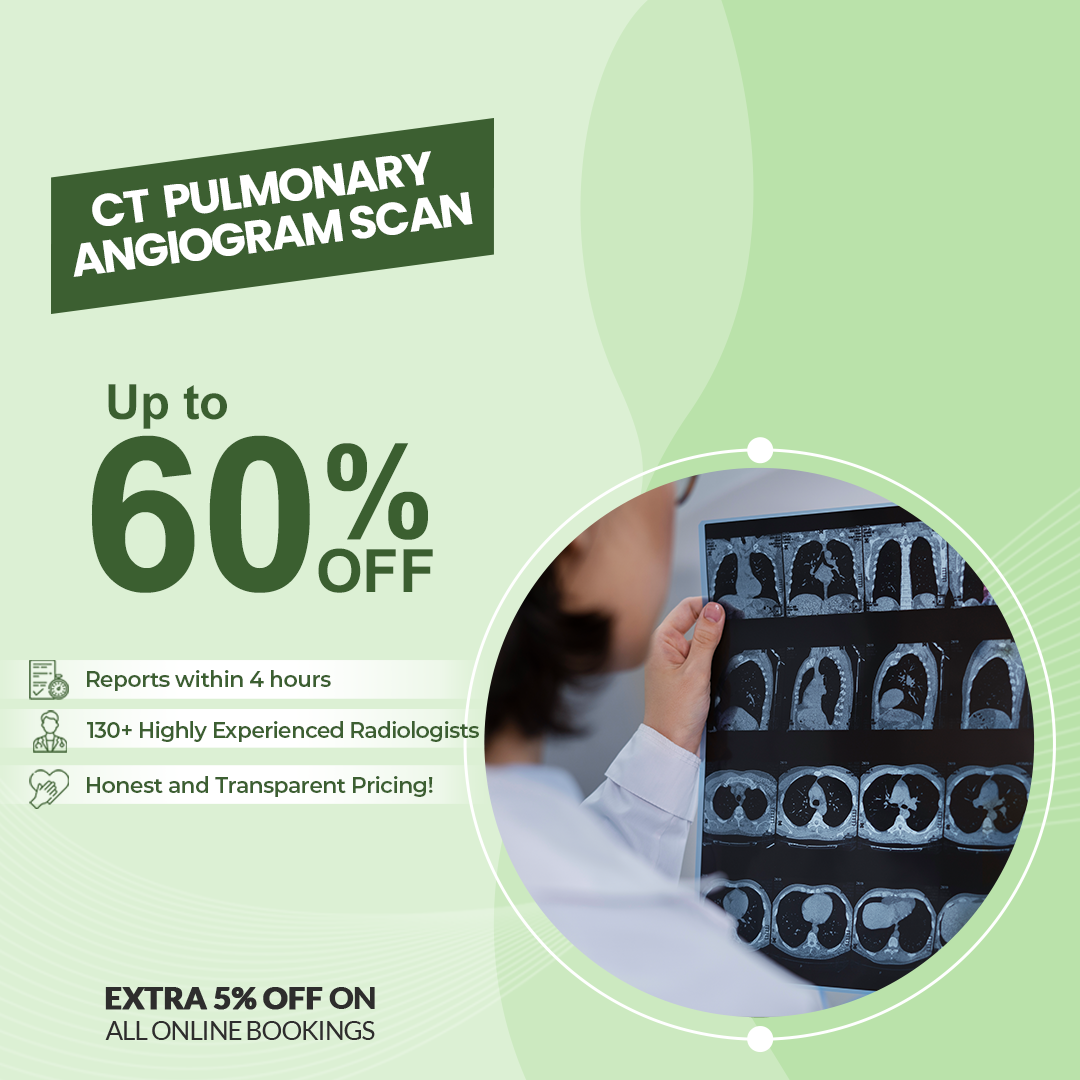 CT Pulmonary Angiogram Scan Aarthi Scans and Labs