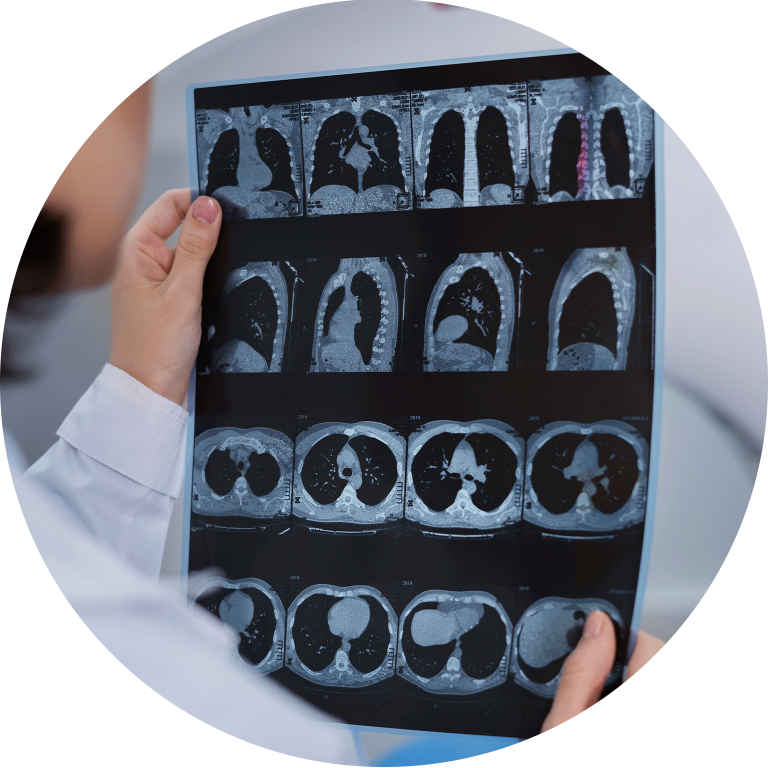 CT Scan Centre CT Scan Brain, Abdomen Aarthi Scans and Labs