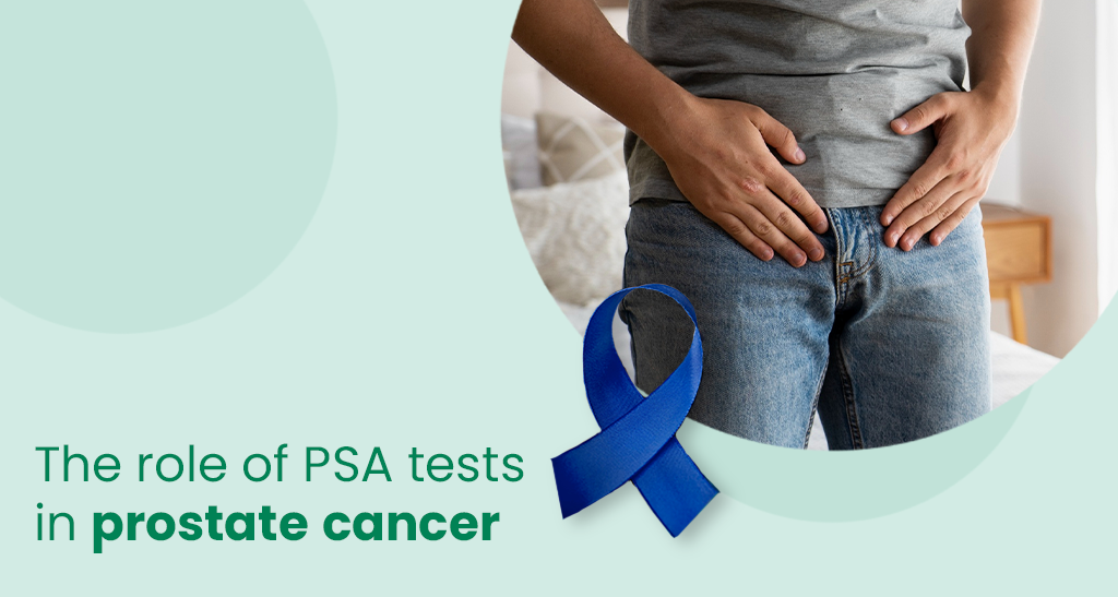 PSA test