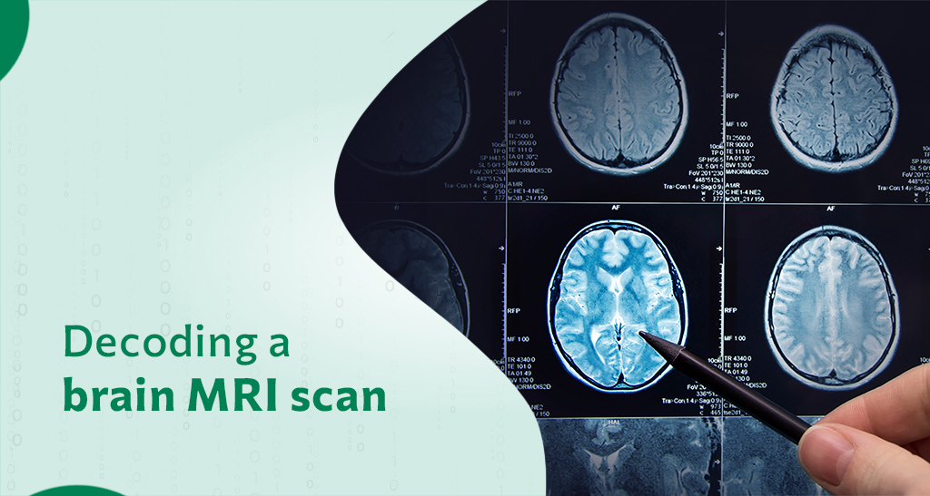 Brain MRI Scan